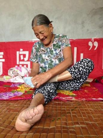 הקורבנות של יופי הסיני, שיש להם רגליים קטנות מפתיע. / צילום: interesnoznat.com. 